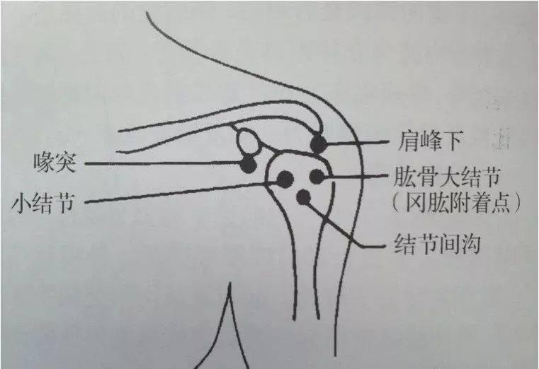 肩背肌筋膜炎痛点图片图片