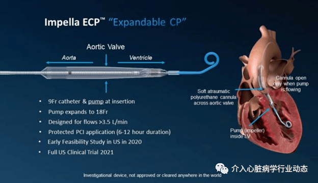 最小心脏泵Impella ECP IDE研究获FDA批准_手机搜狐网