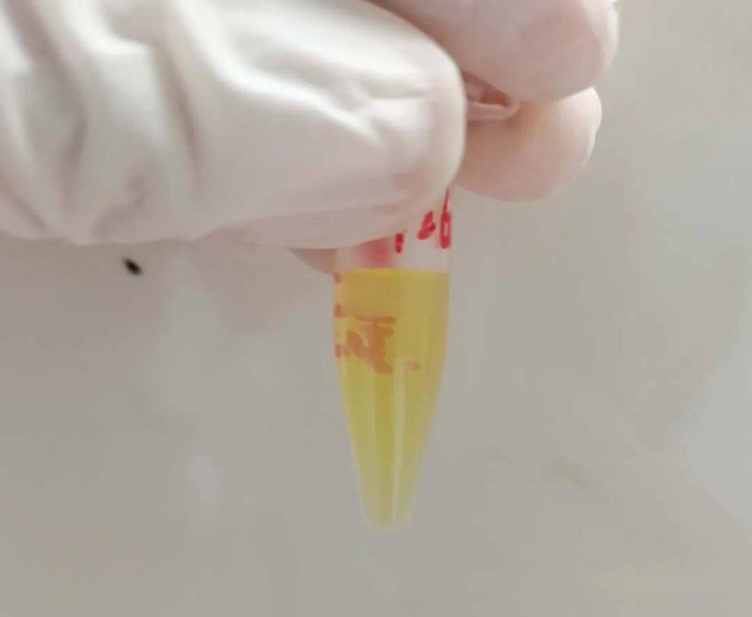 吓人厨师小伙抽出乳白色的牛奶血你可能也爱做同样的事