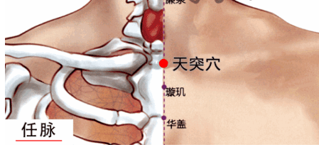 咳嗽痰多痰多咳嗽嗓子痒痒总有痰艾灸这6个祛痰穴位效果惊人