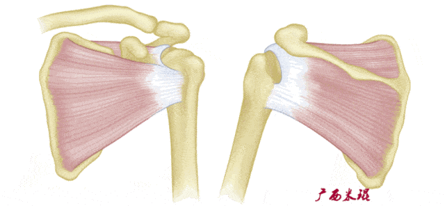 肩肱节律动图图片
