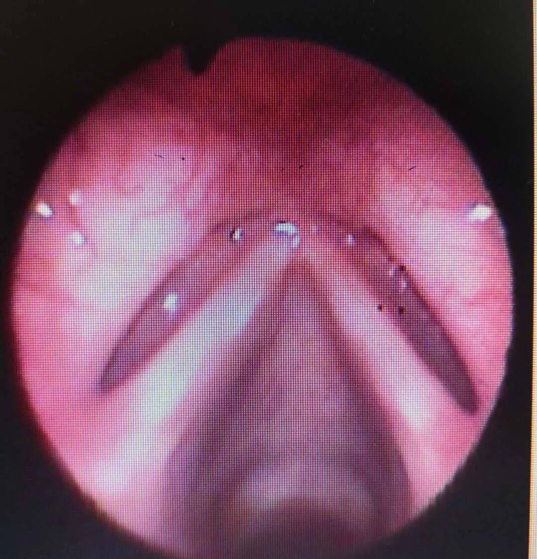 教坛新秀遭遇失声之苦嗓音医疗中心助其解困