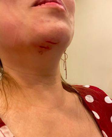 女人间的战争!女歌手夜店遭模特袭击,被对方一脚踢到缝十针