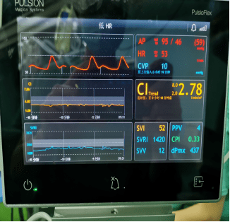 护士需要对患者进行术中输液管理,输血管理,体温管理,生命体征监测