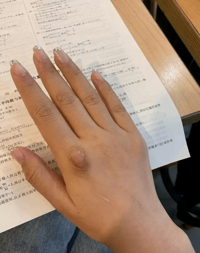 有这样一群女孩,她们以手背虎口处一道疤为标志,辨认彼此是否是同类.