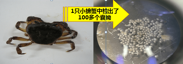 生食螃蟹要谨慎小心感染肺吸虫