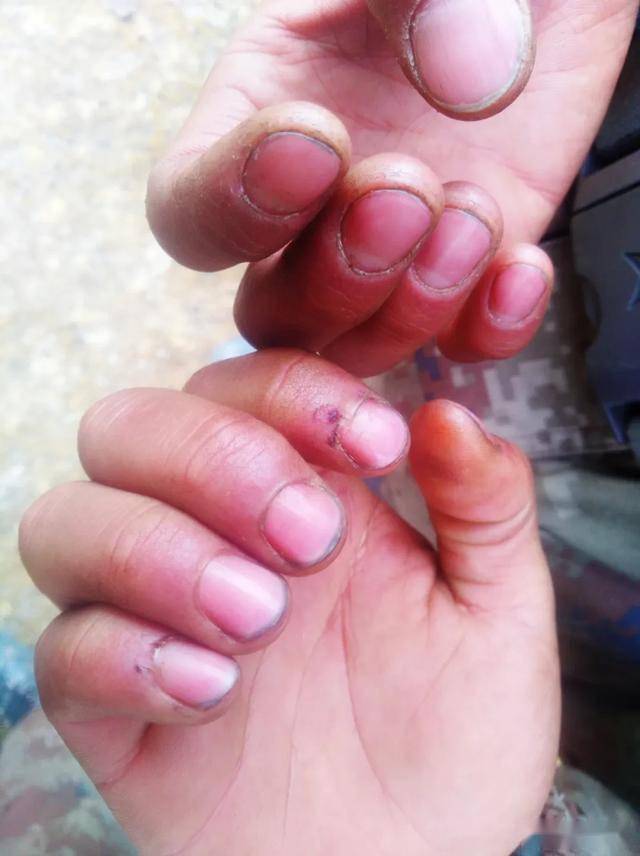 起▼当兵前后对比照立志前往更艰苦的地区后来改了志愿原本是想去海军