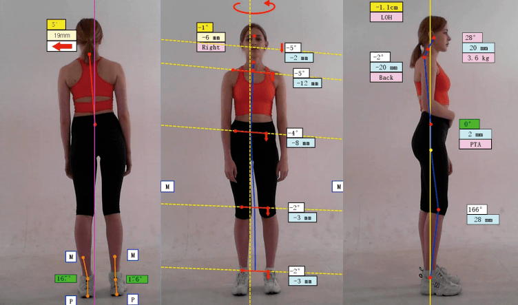 健康源于良好体态