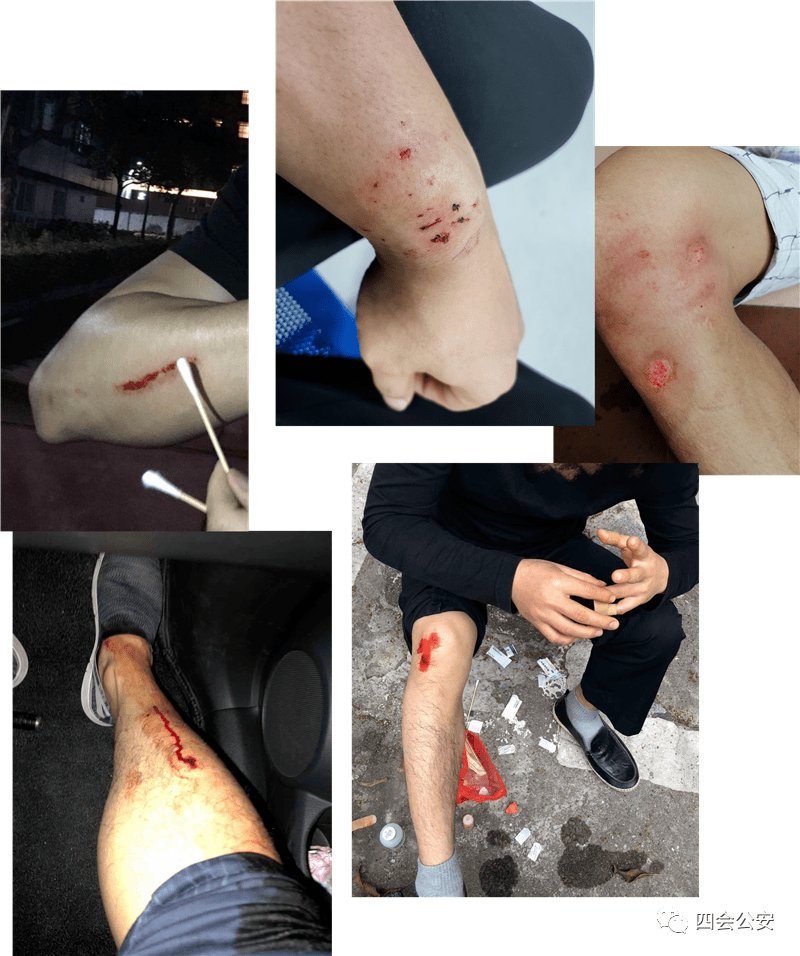 把掌声献给四会的他们每道伤痕都是忠诚担当的见证