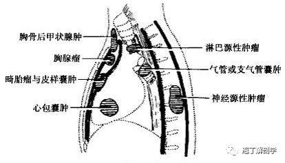 縱隔解剖 縱隔疾病x線診斷要點