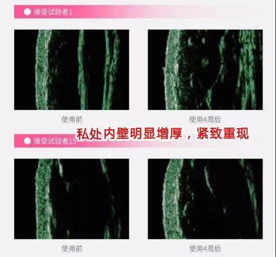 外阴唇为什么会黑_外阴唇为什么会黑_外阴唇为什么会黑