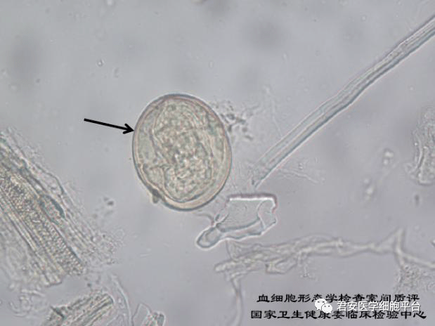 日本血吸虫卵显微镜图片