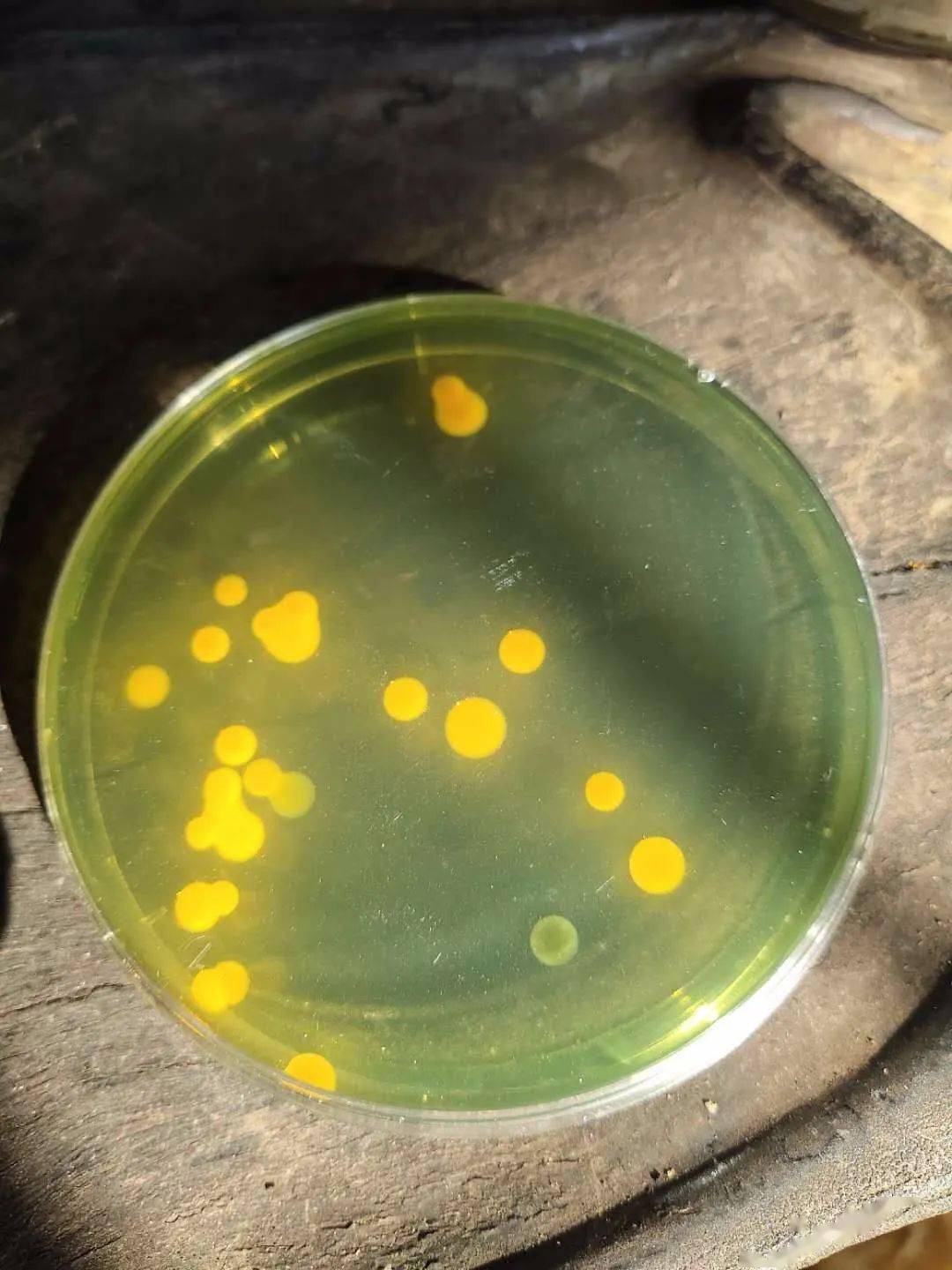 夏天高温肠炎白便爆发把弧菌赶尽杀绝才安心