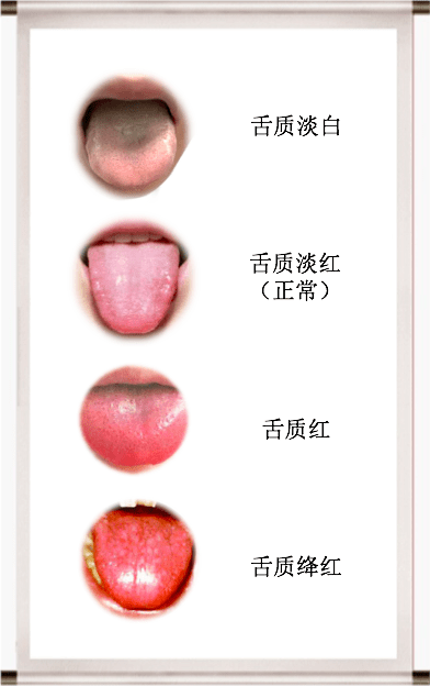 我们舌质和舌苔分开来说哈如果您的舌象不是正常情况l 没有吃有颜色的