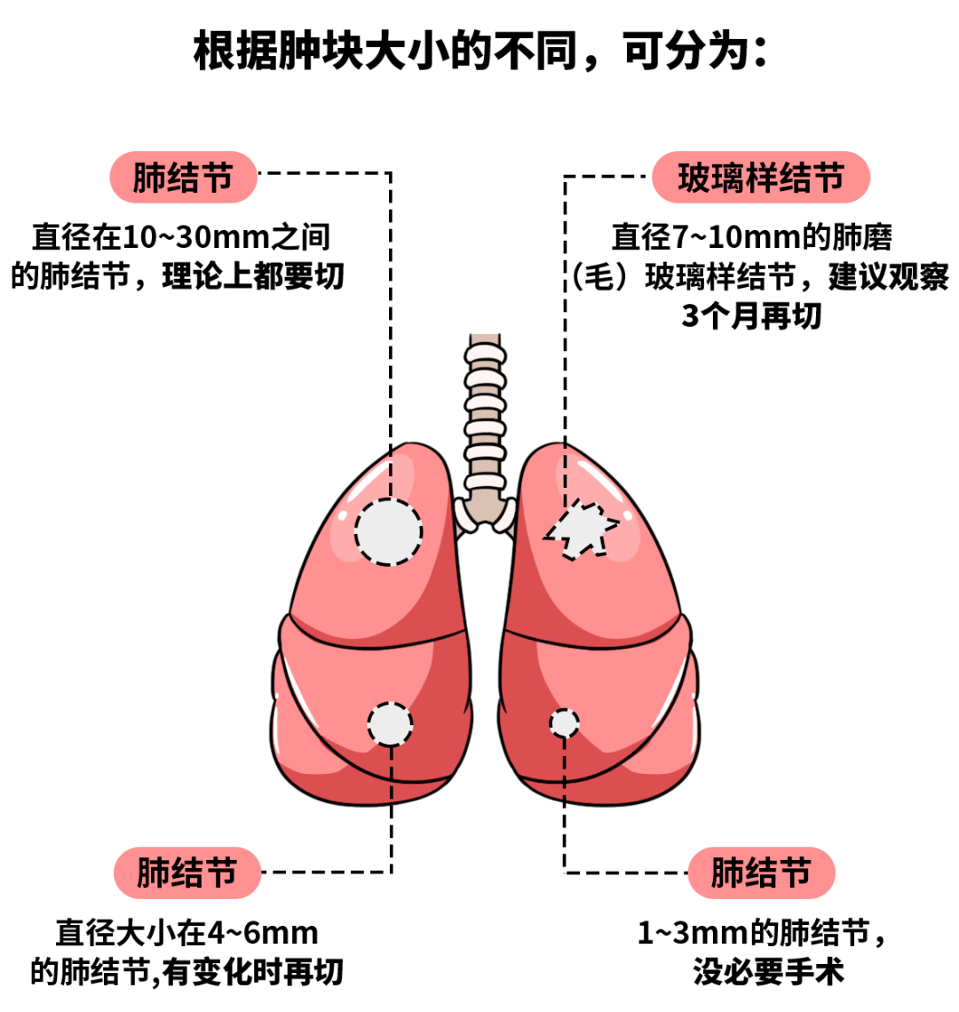 身上这些部位有凸起可能是癌症前兆