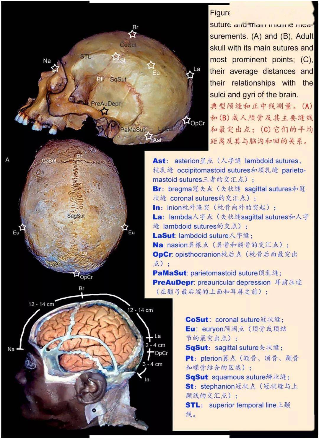 影像解剖超全詳解丨一文讀懂顱骨解剖美圖分享