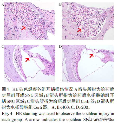 水杨酸钠诱导大鼠耳蜗中dapk1表达改变