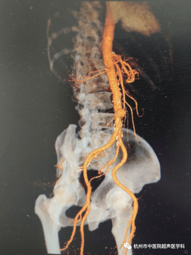 当心腹内不定时炸弹