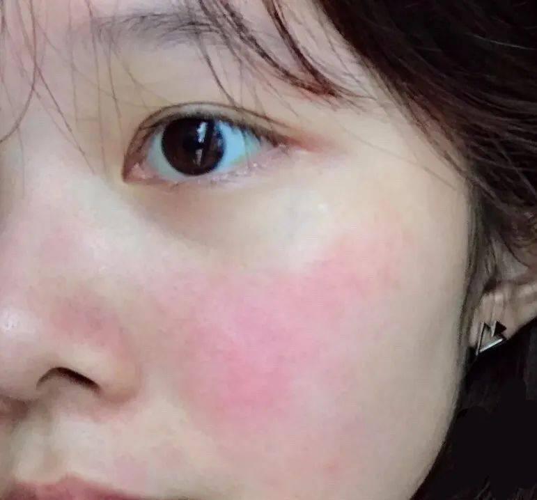 敏感肌保姆级护肤大法,看不懂真的就没救了.