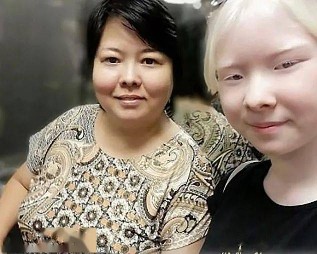 白化病姐妹罕见美照曝光,引6万粉丝赞叹:看一眼就忘不掉!