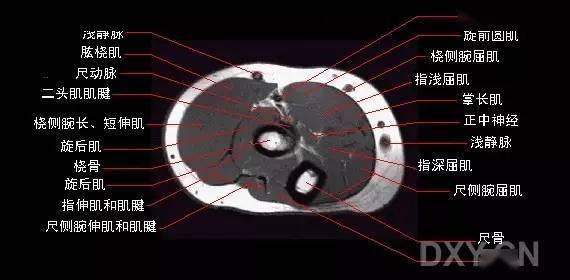 影像解剖肘关节mri图谱超全整理
