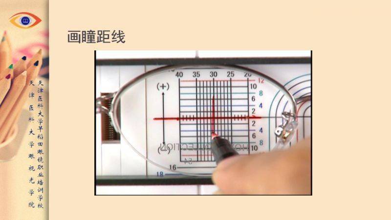 【眼视光】 瞳高的测量方法