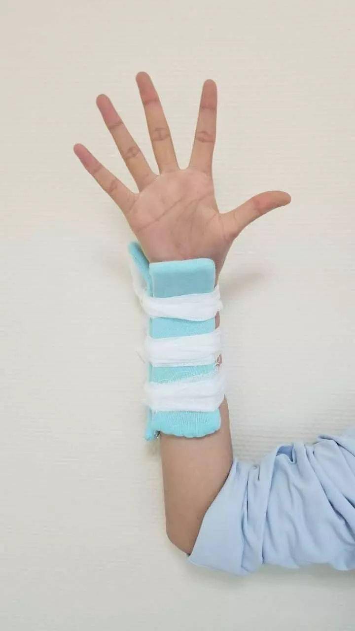 骨折后小夹板固定记住这九点,保你妥妥的.