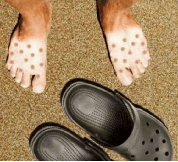 救命我竟然爱上了洞洞鞋