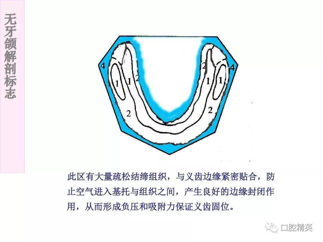 无牙颌解剖标志