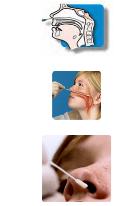 核酸鼻咽拭子采集部位图片
