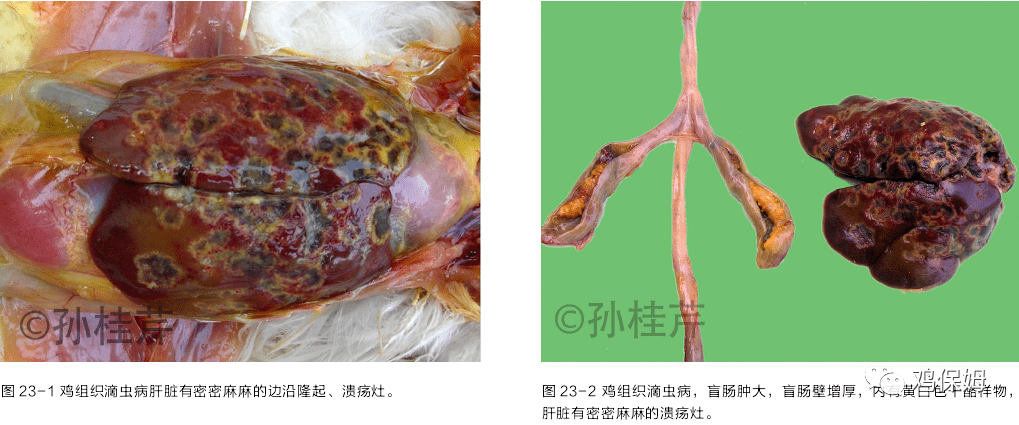 本病的主要病變侷限在盲腸和肝臟,典型的病例可見盲腸腫大,腸壁肥厚