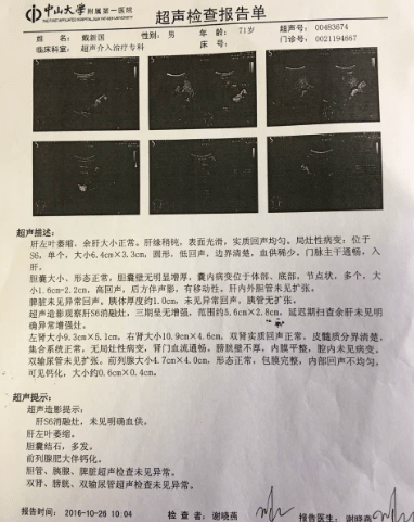 肝癌晚期患者新生记