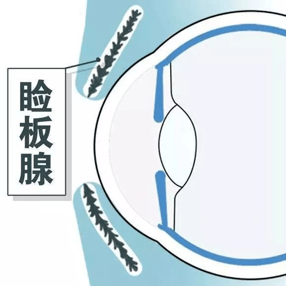 於我們的瞼板腺及結膜等眼部分泌物原來作用還不小眼睛為啥會有分泌物