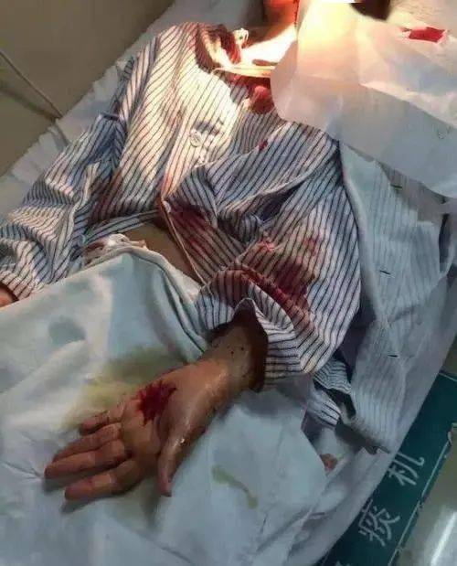 一言不合就砍人保定一男子与邻居发生口角竟被其殴打深夜还被砍流血