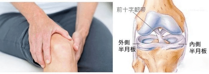 2020最新版半月板损伤术后康复四个阶段