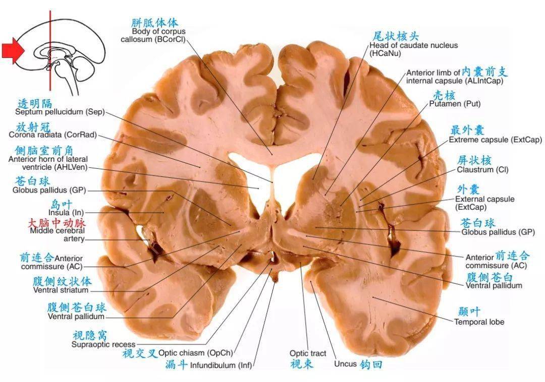 水平位(轴位)断层解剖图矢状位断层解剖:中央核区断层解剖:解剖是医学