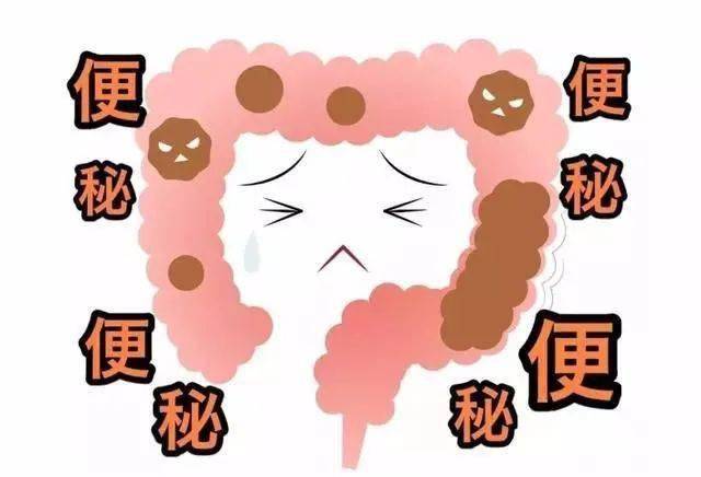 痔疮和便秘究竟哪一个是先来的