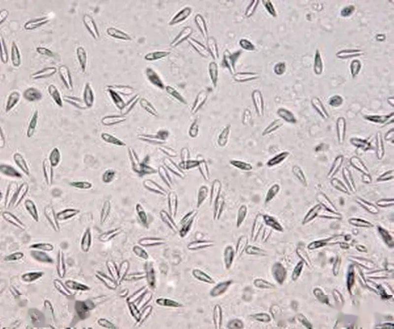 碘泡虫,虫体很小,光学显微镜无法看清其内部结构,全凭人们的经验进行