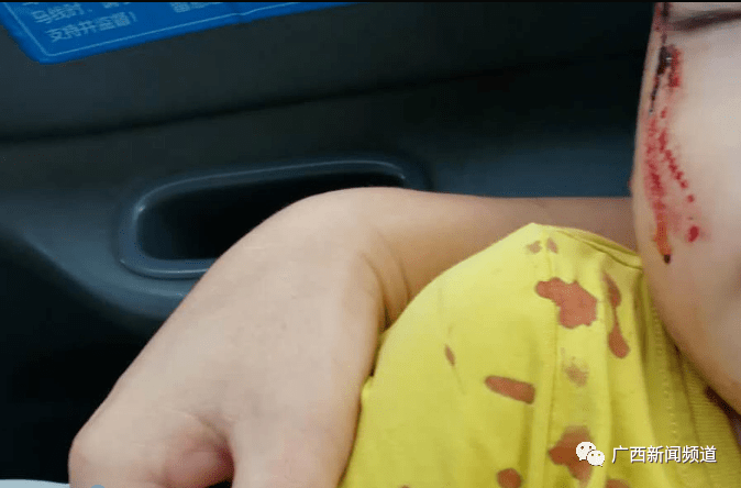 南宁一3岁男童被游乐设施撞到头破血流责任应该谁来担