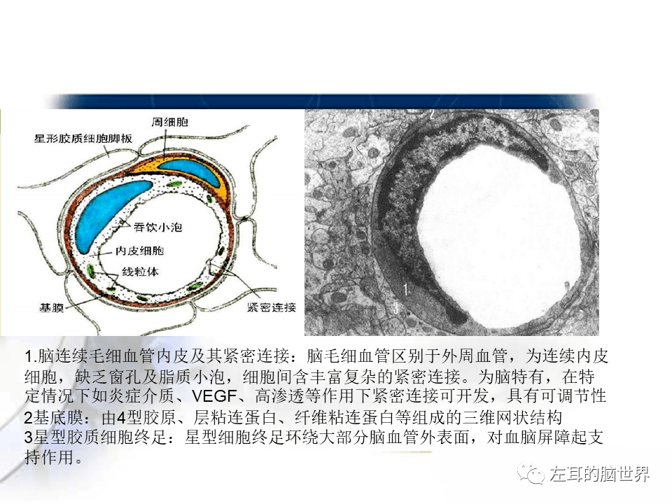 脑肿瘤基础 血脑屏障,强化,水肿