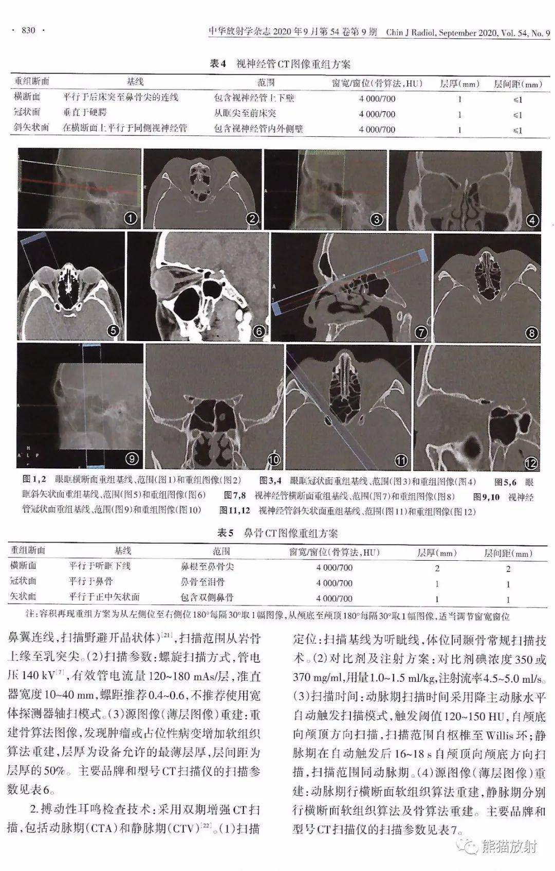 規範與共識丨頭頸部ct檢查和輻射劑量管理專家共識