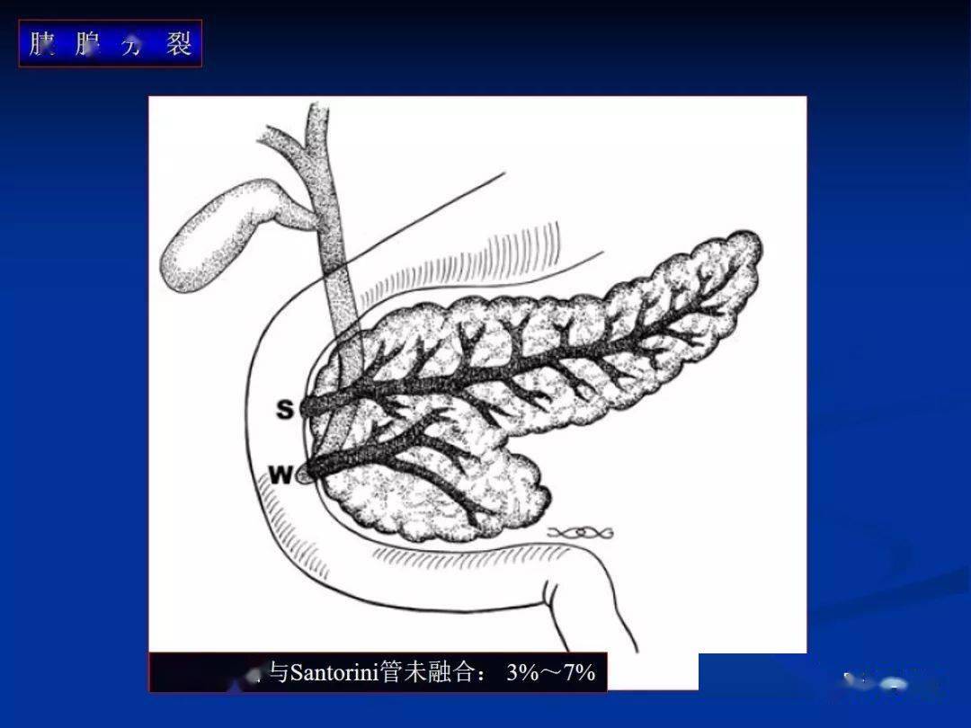 胰腺的解剖與常見變異