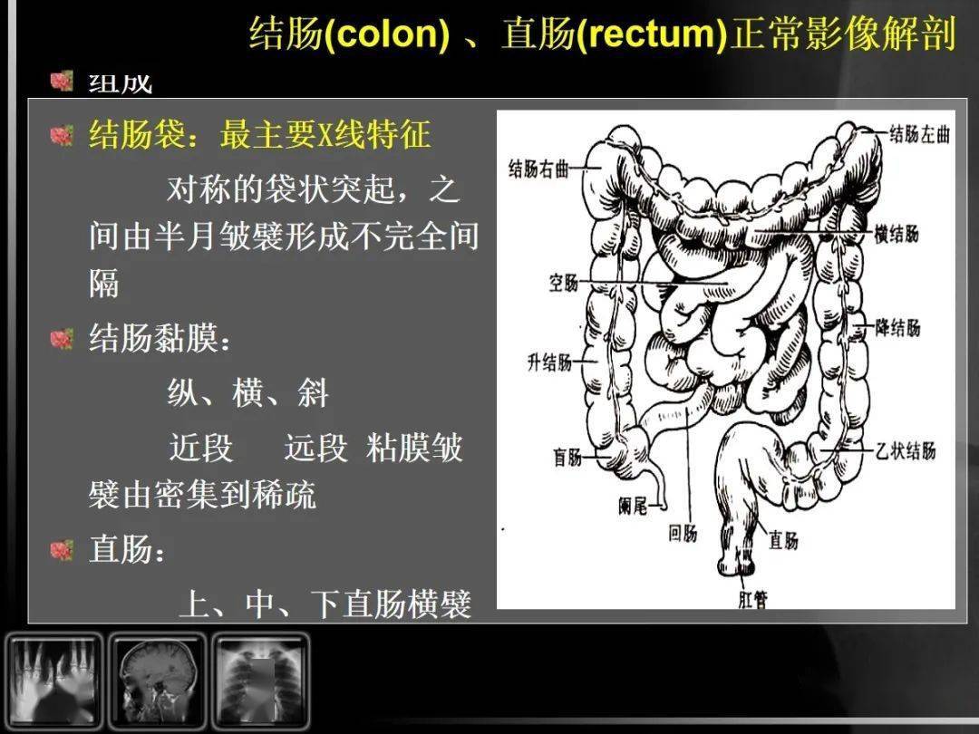 汇总消化道疾病影像诊断与鉴别