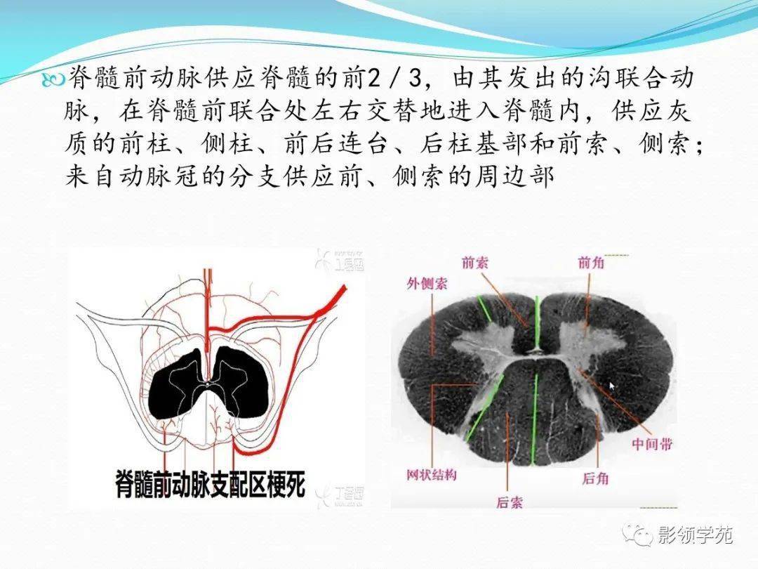 5种髓内非肿瘤性病变影像诊断