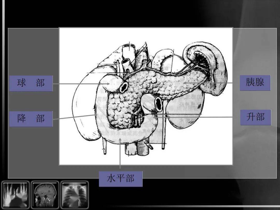 画出肝脏工字结构图片