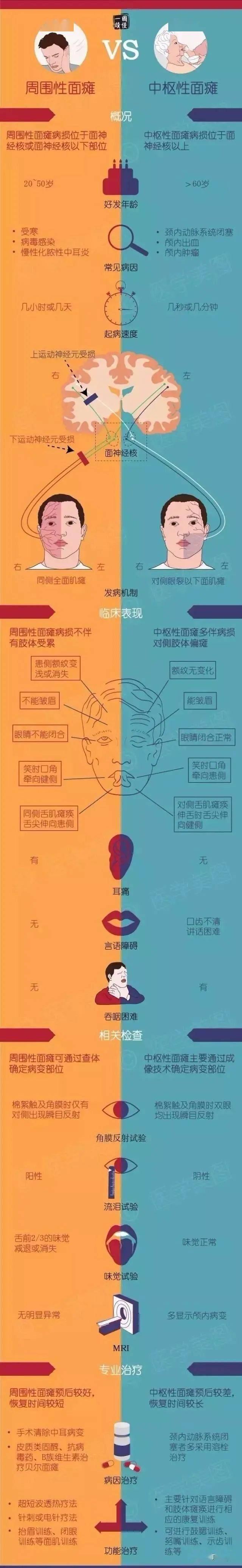 两张图揭示中枢性面瘫vs周围性面瘫