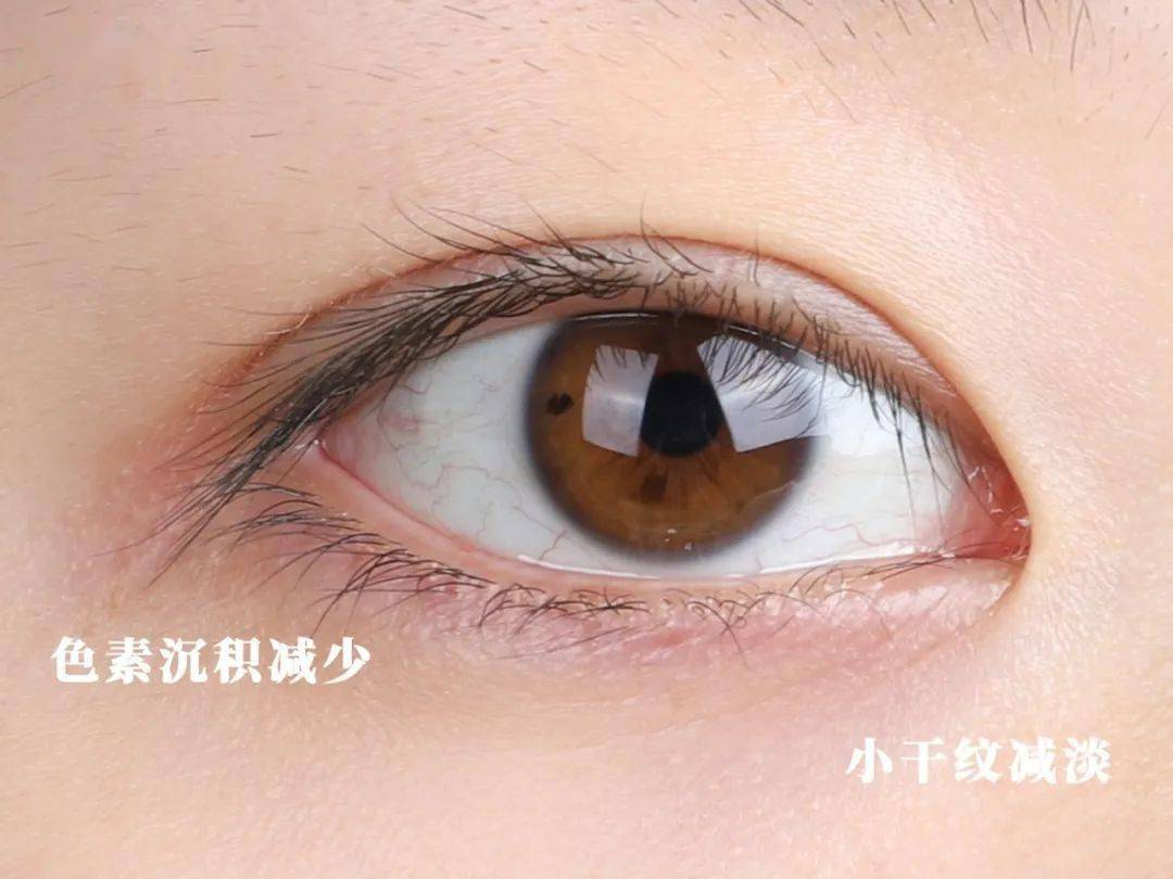 3d胜肽对眼周进行提拉按摩的同时,品牌精心研制的24k纳米金,可以通过