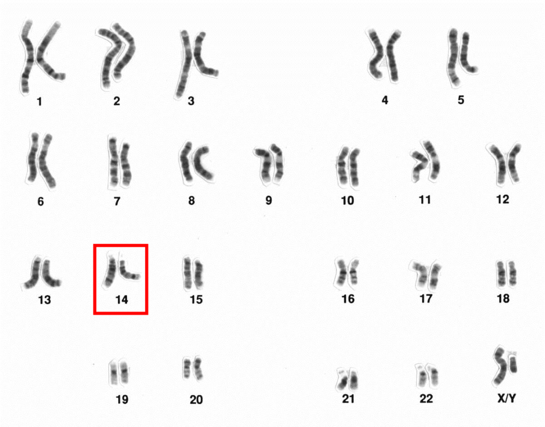 bcr由两种蛋白质组成—重链(hc)和轻链(lc,每一种蛋白质都由特定的