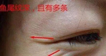 眼角长鱼尾纹是吉还是凶奇准无比