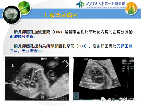 婴儿卵圆孔未闭合症状(婴儿卵圆孔未闭的自愈几率大不大)-第1张图片-鲸幼网
